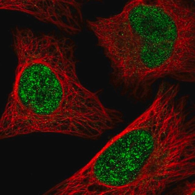 Anti-ATF1 antibody produced in rabbit