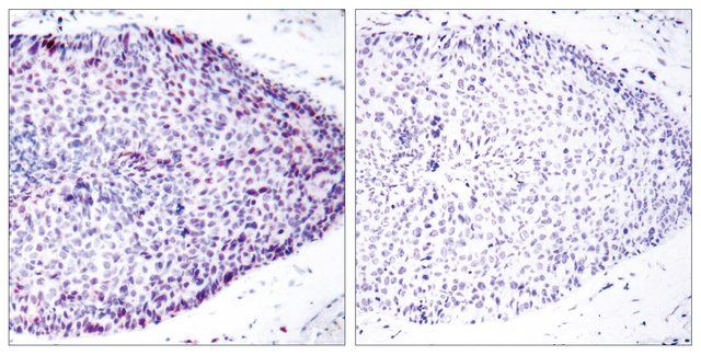 Anti-ATF2 antibody produced in rabbit