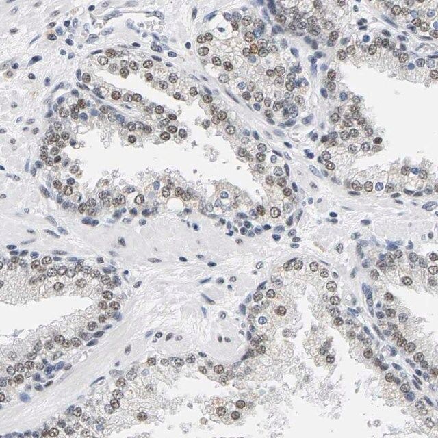 Anti-ATF2 antibody produced in rabbit