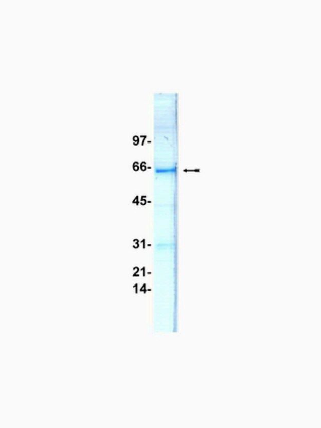 MKK4/SKK1 Protein, inactive, 50 g