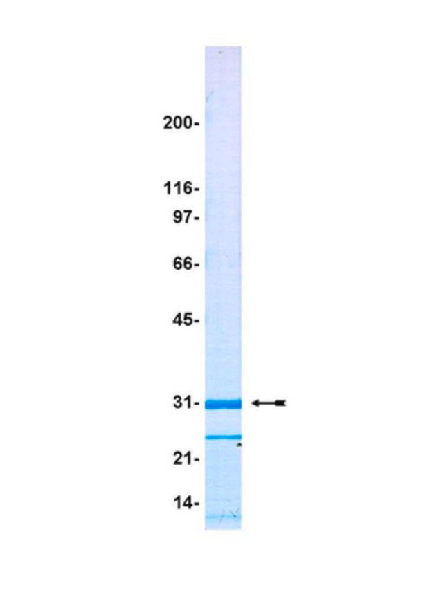 Green fluorescent protein