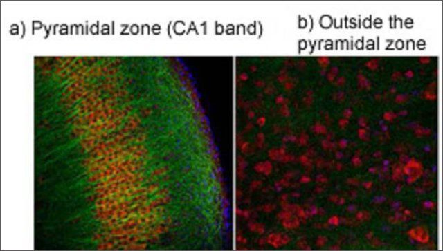 Anti-TRPV4 antibody produced in rabbit