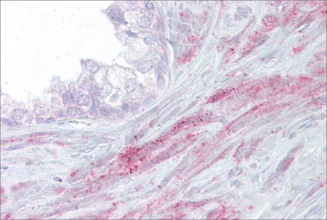 Anti-TRPM8, (N-terminal) antibody produced in rabbit