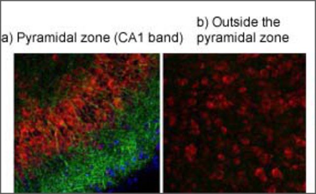 Anti-TRPV4 antibody produced in rabbit