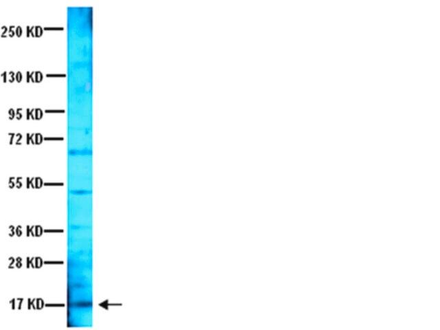 Anti-Brain Derived Neurotrophic Factor Antibody