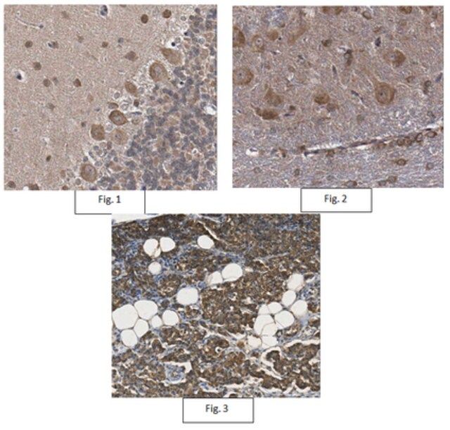 Anti-TRPA1 Antibody