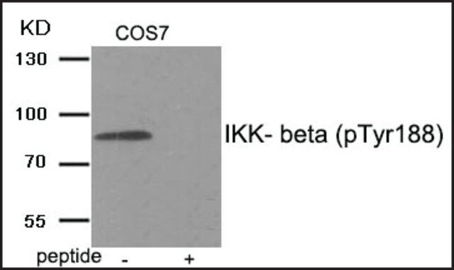 Anti-phospho-IKK- (pTyr<sup>188</sup>) antibody produced in rabbit