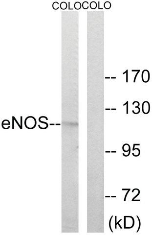 Anti-ENOS antibody produced in rabbit