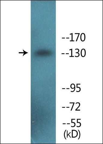 Anti-phospho-IRS-1 (pSer<sup>307</sup>) antibody produced in rabbit