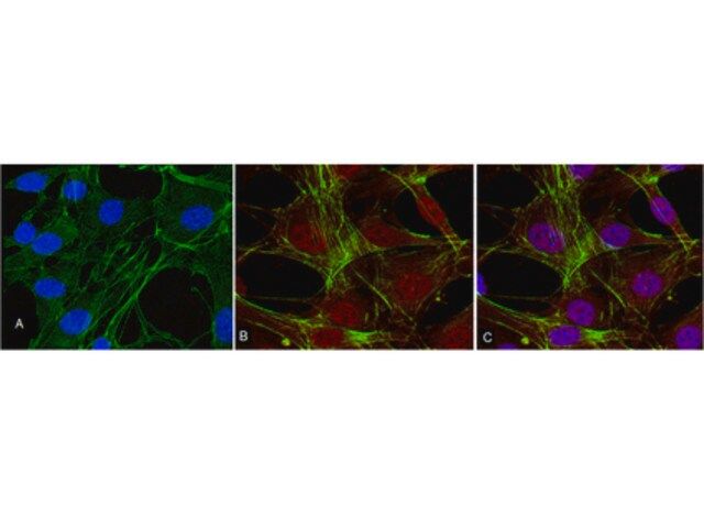 Anti-phospho-Akt (Thr308) Antibody, clone 50-1C-25, rabbit monoclonal