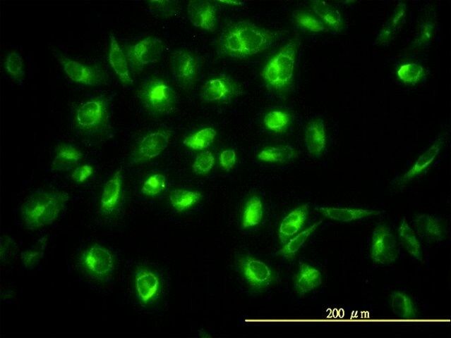 Monoclonal Anti-COG7 antibody produced in mouse