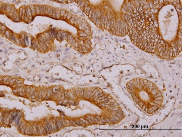 Monoclonal Anti-NDRG4 antibody produced in mouse