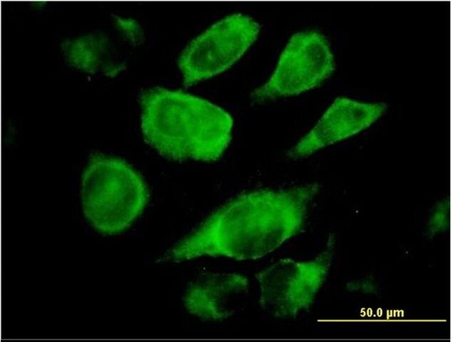 Monoclonal Anti-SSR4 antibody produced in mouse