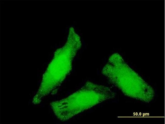 Monoclonal Anti-NIPBL antibody produced in mouse