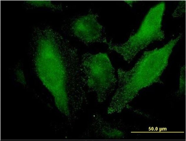 Monoclonal Anti-SRCRB4D antibody produced in mouse