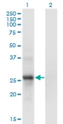 Monoclonal Anti-SNF8 antibody produced in mouse