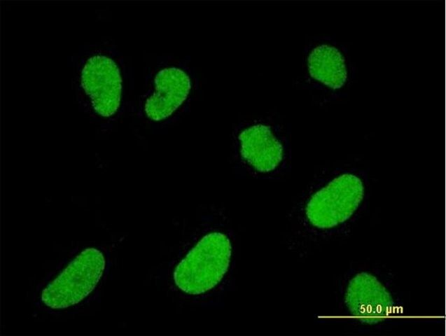 Monoclonal Anti-NFATC2IP antibody produced in mouse