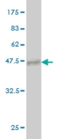 Monoclonal Anti-PIP5K1C antibody produced in mouse