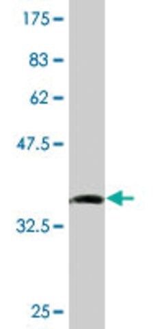 Monoclonal Anti-SMPDL3B antibody produced in mouse