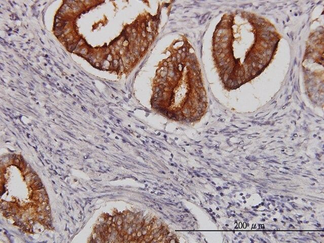 Monoclonal Anti-SLC11A2 antibody produced in mouse