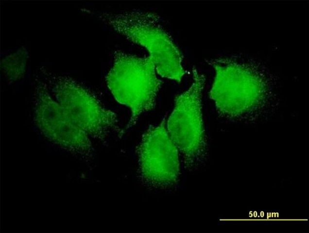 Monoclonal Anti-NOTCH2NL antibody produced in mouse