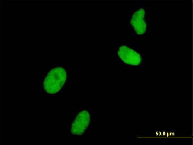 Monoclonal Anti-UHRF1 antibody produced in mouse