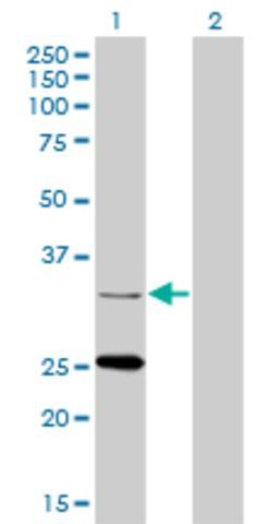 Monoclonal Anti-STAR antibody produced in mouse