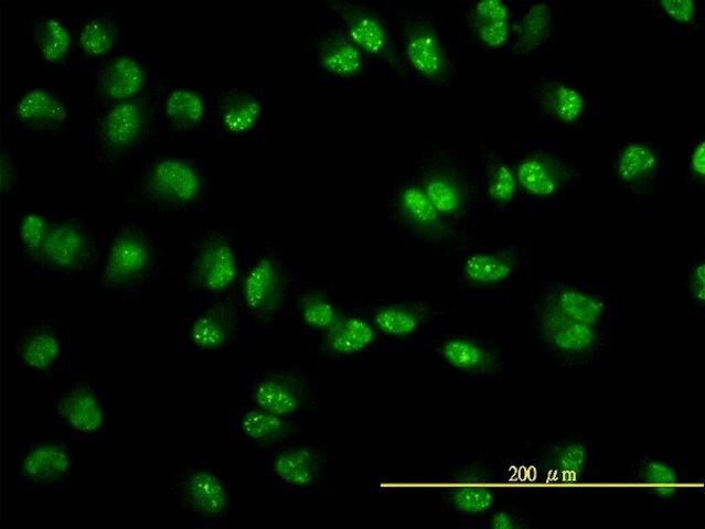 Monoclonal Anti-USP15 antibody produced in mouse