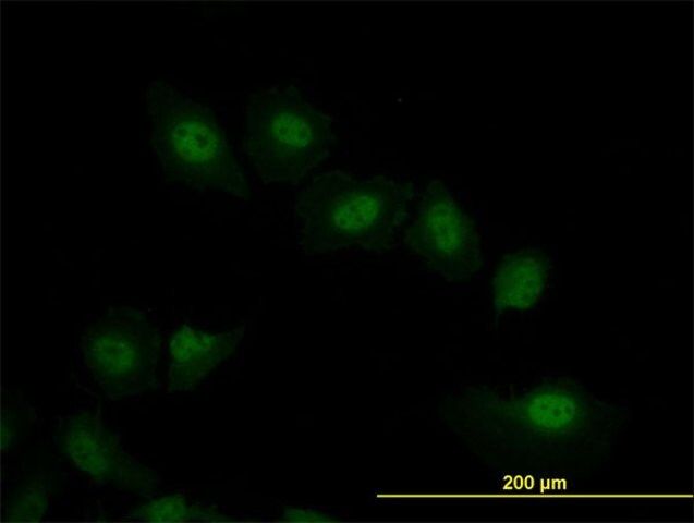 Monoclonal Anti-VRK2 antibody produced in mouse