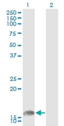 Monoclonal Anti-UBE2L6 antibody produced in mouse