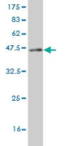 Monoclonal Anti-CABP4 antibody produced in mouse