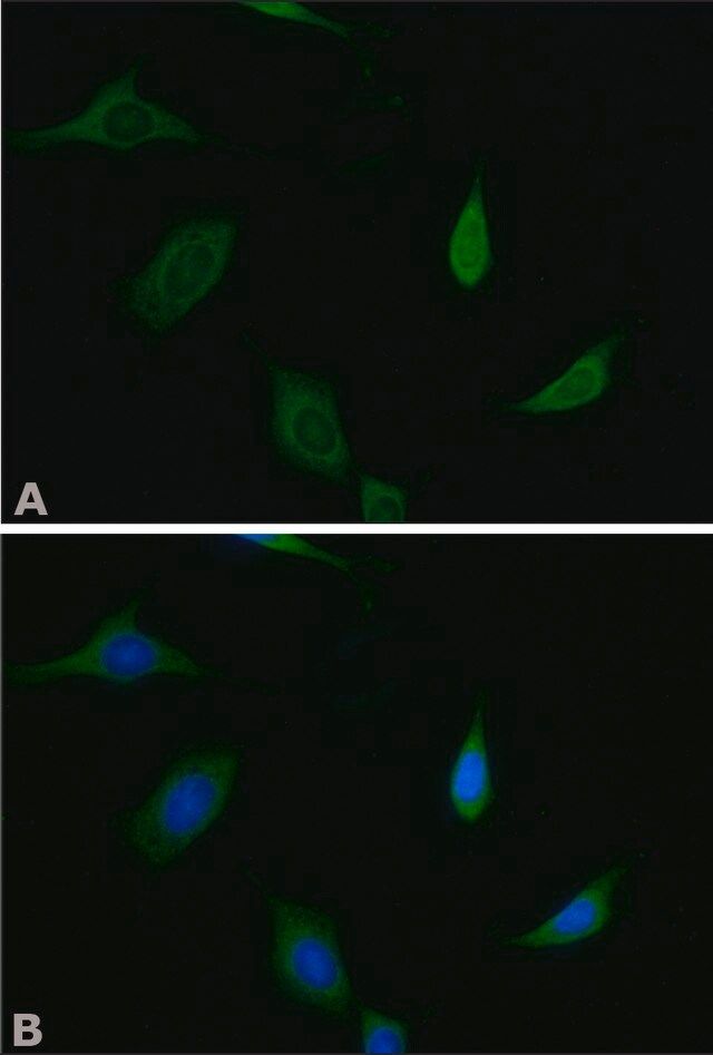 Anti-Munc-18-1 antibody produced in rabbit