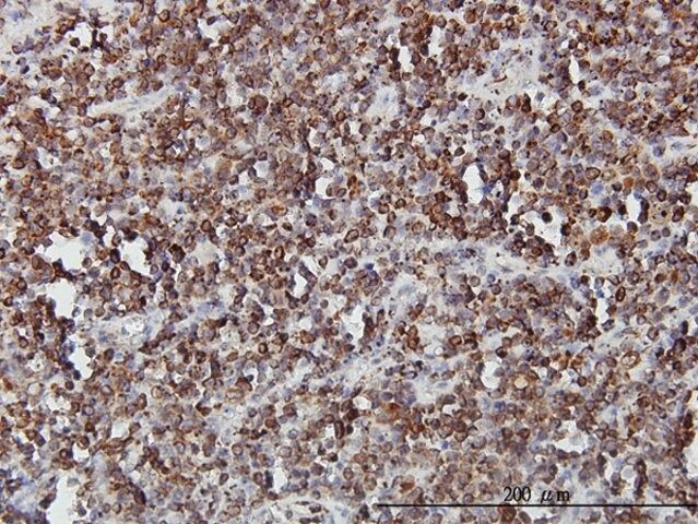 Monoclonal Anti-SLC44A2 antibody produced in mouse