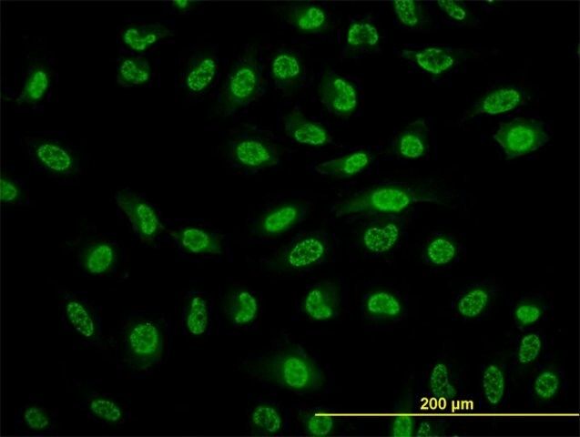 Monoclonal Anti-NFKB1 antibody produced in mouse