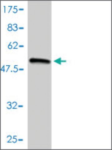 Monoclonal Anti-COL2A1 antibody produced in mouse