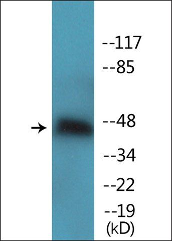 Anti-phospho-Aurora Kinase (pThr<sup>288</sup>) antibody produced in rabbit