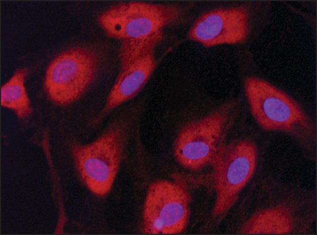 Anti-eIF2B antibody produced in rabbit