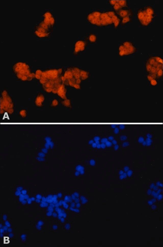 Anti-FOXA1 antibody produced in rabbit