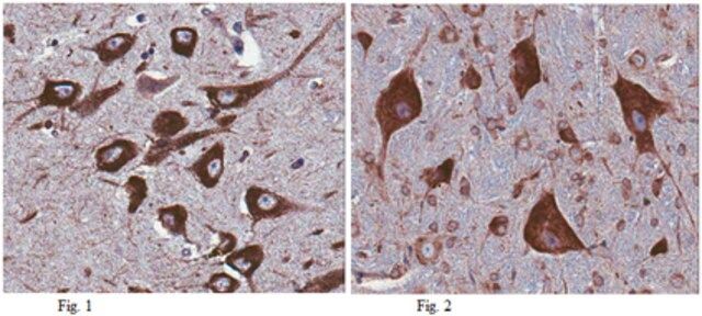 Anti-MANF Antibody