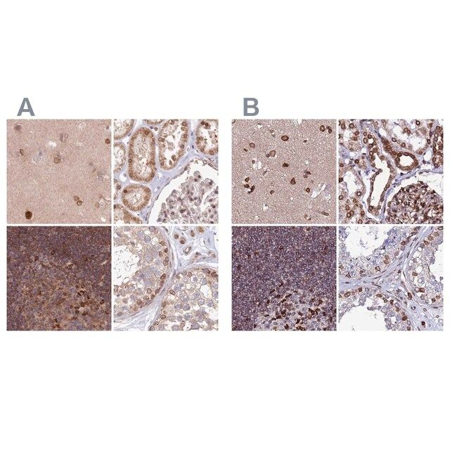 Anti-TOR1AIP1 antibody produced in rabbit