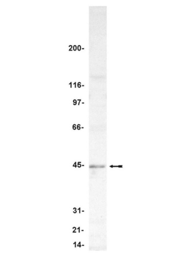 Anti-PP2A-methylesterase/PME-1 Antibody