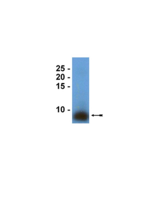 Anti-Surfactant Protein B Antibody