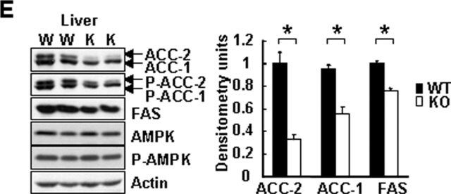 Anti-phospho-Acetyl CoA Carboxylase (Ser79) Antibody