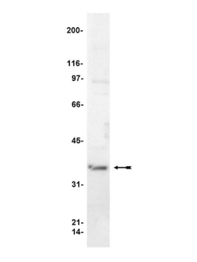 Anti-G Antibody