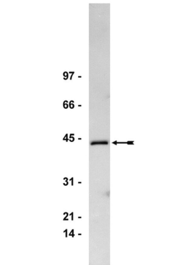 Anti-Gq/11 Antibody, CT