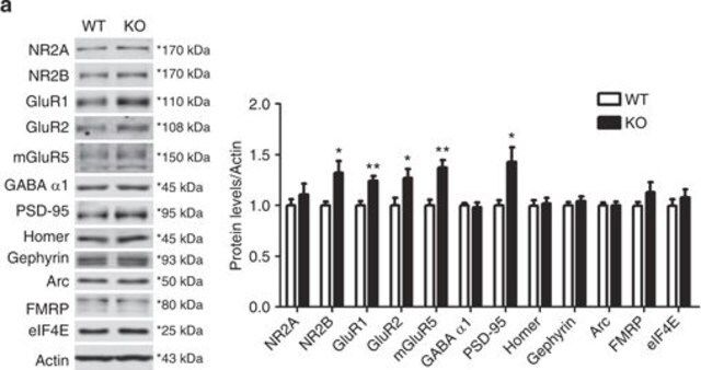 Anti-GABAA Receptor 1 Antibody