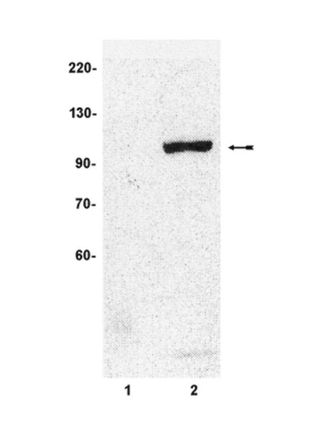 Anti-phospho-STAT6 (Tyr641) Antibody