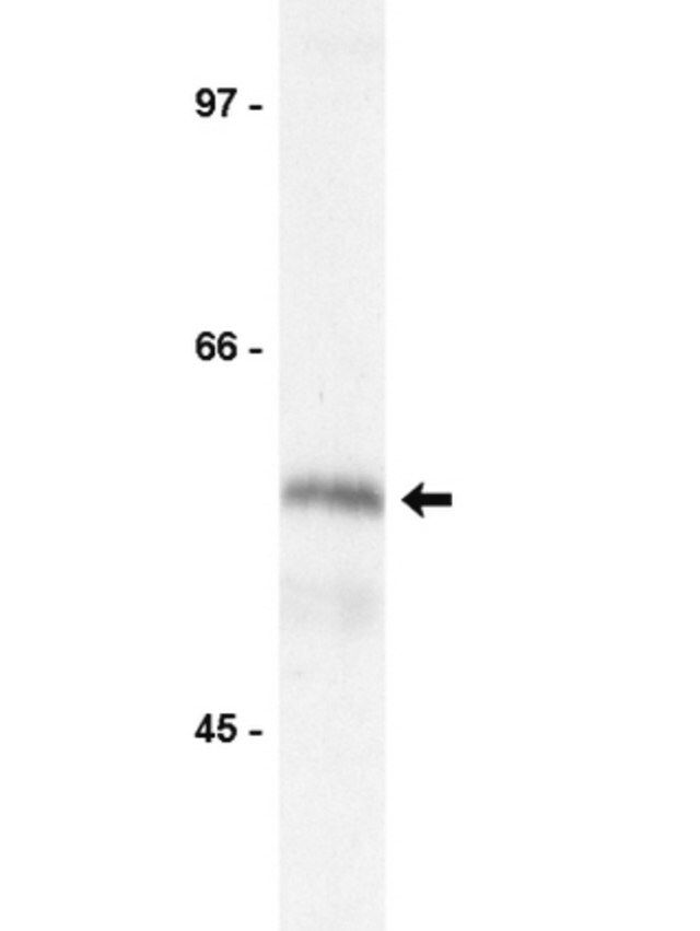 Anti-Kip2 Antibody