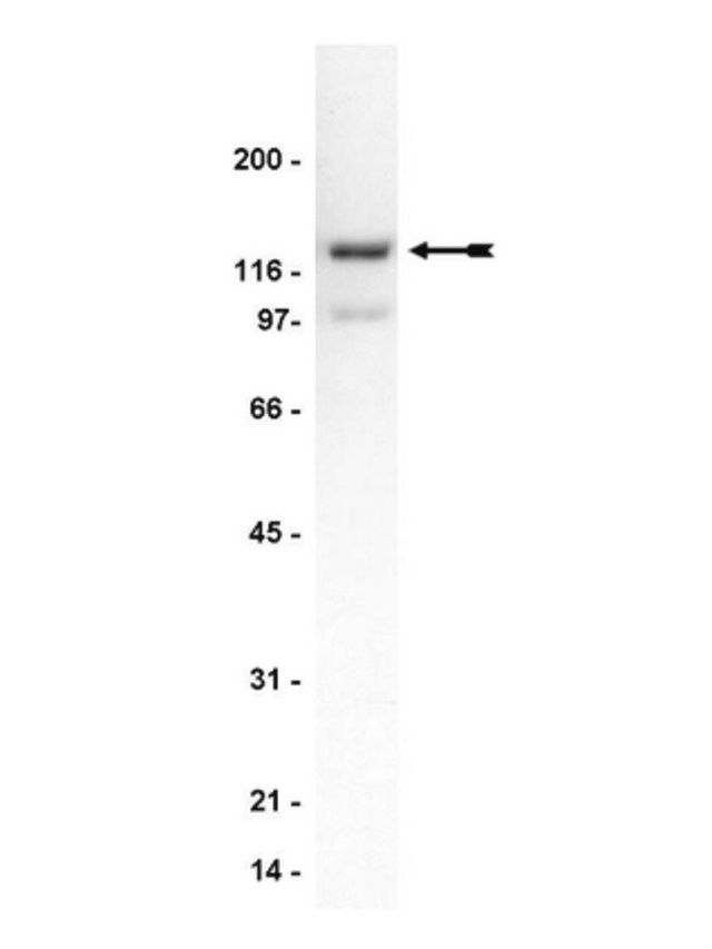 Anti-Spinophilin/Neurabin-II Antibody