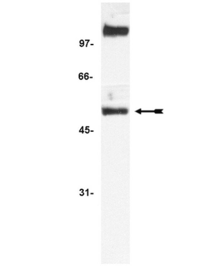 Anti-NFB p52 Antibody